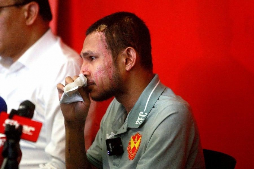 Những vết thương sẽ theo Faisal đến cuối đời nhưng không thể đánh gục anh.