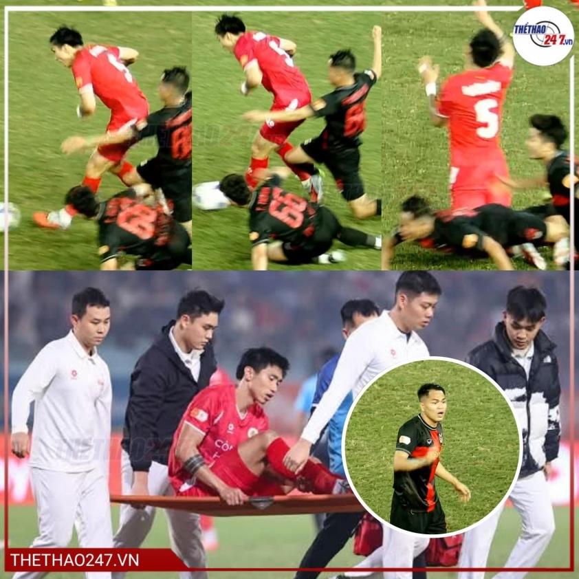 Trước đó, Văn Hậu phải rời sân bằng cáng ở vòng 12 V-League.